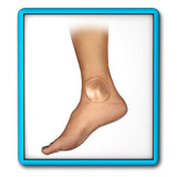 Bunga 2.5" Gel Discs